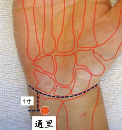 通里穴：清心火、通心脉