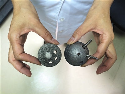 3D打印髋关节来了